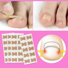 Load image into Gallery viewer, Painless Toenail Patch
